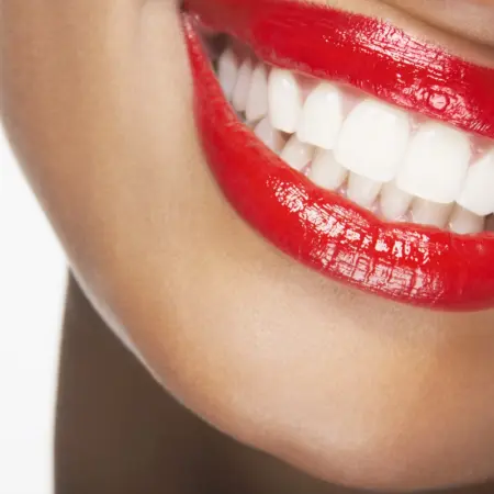 5 alimentos que clareiam seus dentes