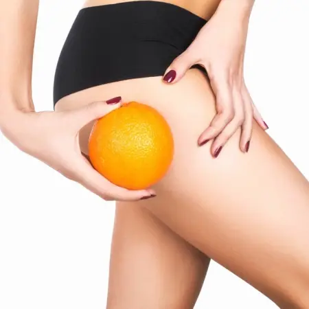 15 tricks you didn't know to achieve cellulite-free legs
