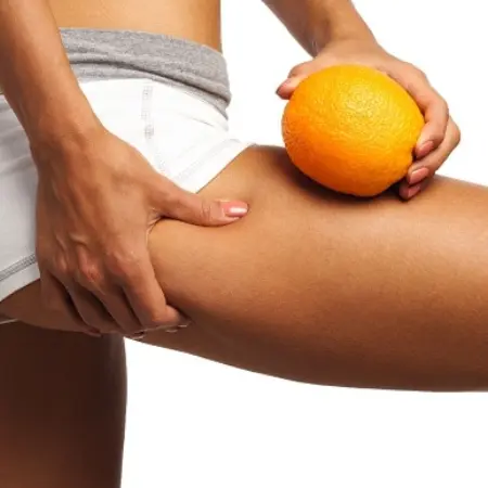 10 foods against cellulite