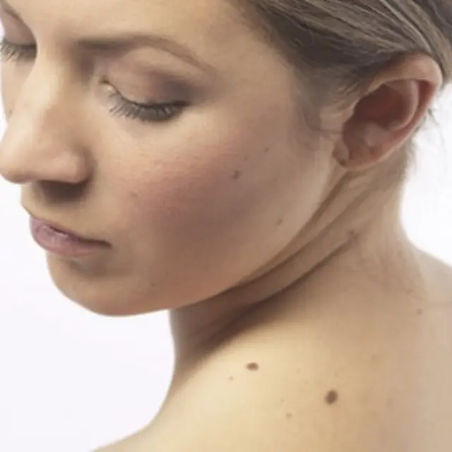 How to Naturally Lighten Skin